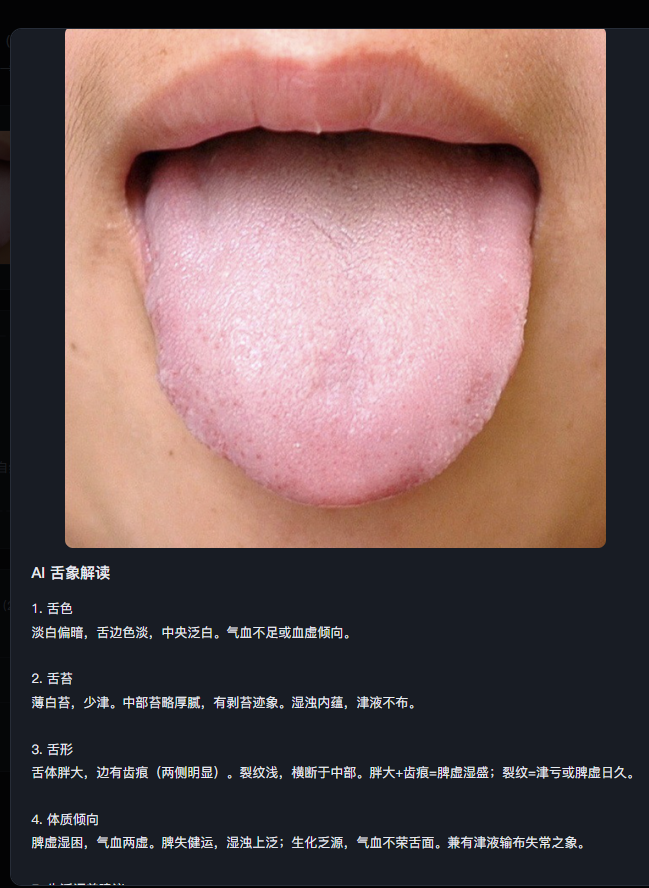 tongue AI 舌诊 Web 系统